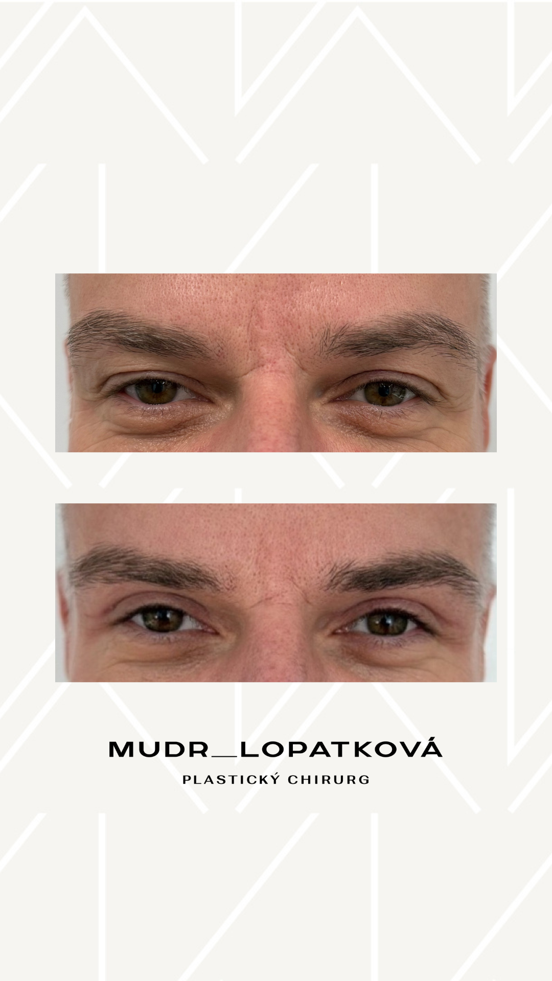 mudrlopatkova - ilustračná fotka časti tela